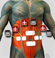 Eabdominal 5 Electroestimulacion Abdominal, Como colocar los electrodos en el abdomen