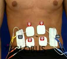 Eabdominal8 Electroestimulacion Abdominal, Como colocar los electrodos en el abdomen