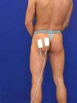 Como colocar los electrodos en los Gluteos