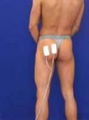 Como colocar los electrodos en los Gluteos