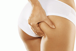 Celulitis, caminar para combatirla