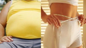Obesidad y sedentarismo se relacionan con enfermedad diverticular