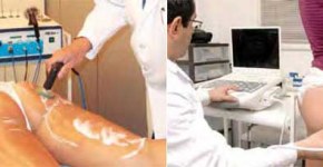 Radiofrecuencia para la celulitis