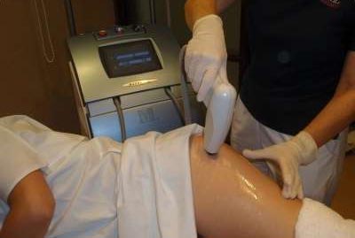 ultracavitacion